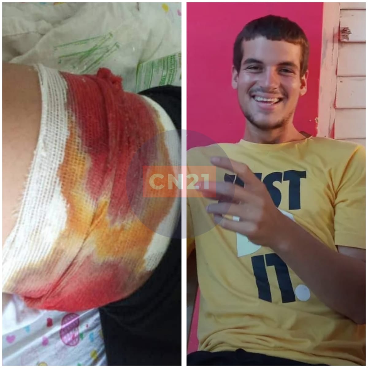 MADRE DE RECLUTA HERIDO POR DISPARO EN EL SERVICIO MILITAR DENUNCIA EL CASO